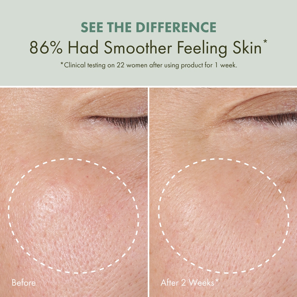 Checks and Balances™ Daily Exfoliating with AHA, BHA and Witch Hazel, 150 ml